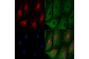 ABIN6261079 and ABIN6276536 staining  cells by IF/ICC.