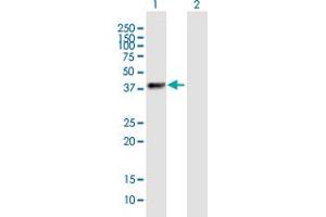 Western Blot analysis of ZNF385B expression in transfected 293T cell line by ZNF385B MaxPab polyclonal antibody. (ZNF385B anticorps  (AA 1-369))