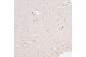 Immunohistochemistry of paraffin-embedded rat brain using ABCF2 antibody. (ABCF2 anticorps  (AA 1-250))