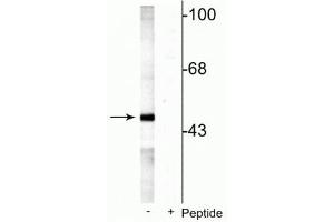 Western blot of rat testes lysate showing specific labeling of the ~49 kDa MEK5 protein phosphorylated at Ser311 Thr315 in the first lane (-). (MAP2K5 anticorps  (pSer311, pThr315))