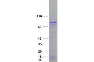 Validation with Western Blot