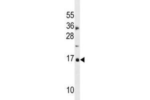 CDKN2A antibody western blot analysis in MDA-MB453 lysate.