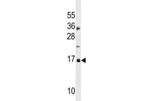 CDKN2A antibody western blot analysis in MDA-MB453 lysate. (CDKN2A anticorps  (AA 1-30))