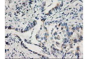 Image no. 5 for anti-Cyclin-Dependent Kinase 2 (CDK2) antibody (ABIN1497394) (CDK2 anticorps)