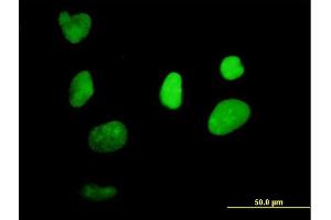 Immunofluorescence of purified MaxPab antibody to XRCC1 on HeLa cell.