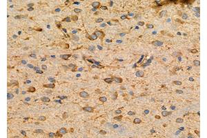 ABIN6264935 and ABIN6276742 at 1/100 staining Rat brain tissue by IHC-P. (SCARB1 anticorps  (Internal Region))