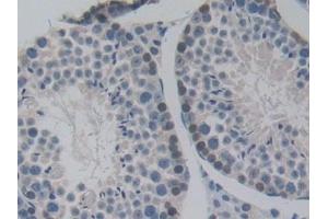 Detection of NUP85 in Mouse Testis Tissue using Polyclonal Antibody to Nucleoporin 85 (NUP85) (NUP85 anticorps  (AA 418-653))