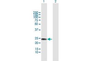 Western Blot analysis of IFNA8 expression in transfected 293T cell line by IFNA8 MaxPab polyclonal antibody.