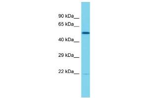Host: Rabbit  Target Name: Elf2  Sample Tissue: Rat Thymus lysates  Antibody Dilution: 1. (ELF2 anticorps  (Middle Region))