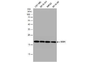 WB Image SOD1 antibody detects SOD1 protein by western blot analysis. (SOD1 anticorps)