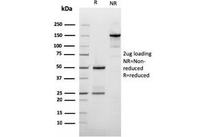 SDS-PAGE Analysis Purified Filaggrin Mouse Recombinant Monoclonal Antibody (rFLG/1561). (Recombinant Filaggrin anticorps  (AA 198-288))