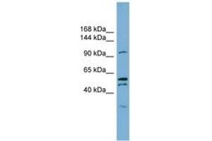 Image no. 1 for anti-Anoctamin 6 (ANO6) (AA 791-840) antibody (ABIN6743329) (Anoctamin 6 anticorps  (AA 791-840))