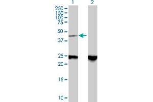 Western Blot analysis of ZNF24 expression in transfected 293T cell line by ZNF24 MaxPab polyclonal antibody. (ZNF24 anticorps  (AA 1-368))