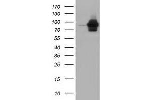 Western Blotting (WB) image for anti-Aldehyde Dehydrogenase 1 Family, Member L1 (ALDH1L1) antibody (ABIN1496582) (ALDH1L1 anticorps)