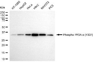 Western blotting analysis using phospho-PP2A alpha (Y307) antibody (ABIN7800021).