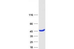 Validation with Western Blot