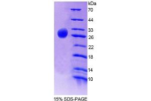 SDS-PAGE (SDS) image for Guanine Nucleotide Binding Protein (G Protein), alpha Z Polypeptide (GNaZ) (AA 2-219) protein (His tag) (ABIN4989080) (GNaZ Protein (AA 2-219) (His tag))