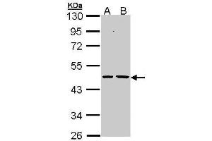 WB Image Sample (30 ug of whole cell lysate) A: H1299 B: Hela 10% SDS PAGE antibody diluted at 1:1000 (EPHX1 anticorps)
