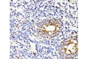 Immunohistochemistry of paraffin-embedded Human appendix using PDCD10 Polyclonal Antibody at dilution of 1:100 (40x lens).