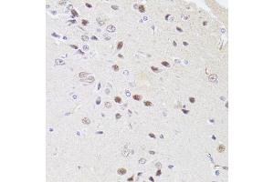 Immunohistochemistry of paraffin-embedded rat brain using DMAP1 antibody (ABIN4903487) at dilution of 1:100 (40x lens). (DMAP1 anticorps)