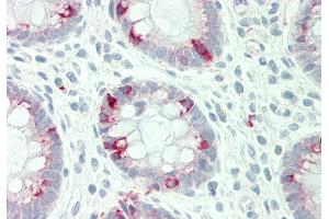 Rabbit Anti-STYK1 antibody  Formalin Fixed Paraffin Embedded Tissue: Human Colon Primary antibody Concentration: 1:100 Secondary Antibody: Donkey anti-Rabbit-Cy3 Secondary Antibody Concentration: 1:200 Magnification: 20x Exposure Time: 0.