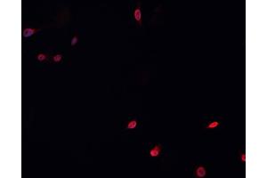 ABIN6266753 staining HeLa  cells by IF/ICC.