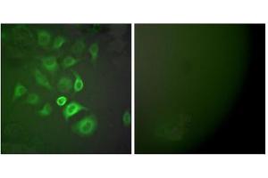 Immunofluorescence analysis of A549 cells, using S100 A1 antibody (ABIN5976502). (S100A1 anticorps  (N-Term))