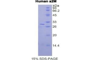 SDS-PAGE of Protein Standard from the Kit (Highly purified E. (alpha 2 Macroglobulin Kit CLIA)