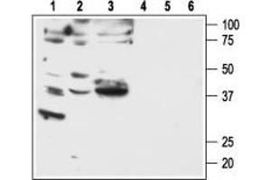 Western blot analysis of human breast adenocarcinoma MDA-MB-231 (lanes 1 and 4) and MDA-MB-468 (lanes 2 and 5), and human lung small cell carcinoma NCI-H526 (lanes 3 and 6) cell lines: - 1-3. (F2RL1 anticorps  (C-Term, Intracellular))