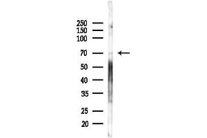 Western blot analysis of lysates from Hela cells(heat-shock,45 min treatment), using KMC/SUV4-20h2 Antibody at 1/1000 dilution.