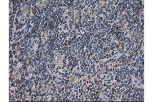 Image no. 5 for anti-ADP-Ribosylation Factor GTPase Activating Protein 1 (ARFGAP1) antibody (ABIN1496679) (ARFGAP1 anticorps)