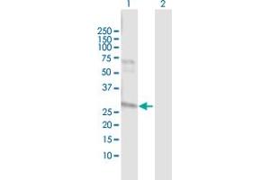 Western Blot analysis of NAT2 expression in transfected 293T cell line by NAT2 MaxPab polyclonal antibody. (NAT2 anticorps  (AA 1-290))