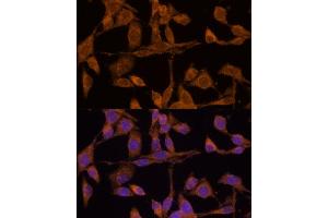 Immunofluorescence analysis of HeLa cells using USP15 Polyclonal Antibody (ABIN6130759, ABIN6149998, ABIN6149999 and ABIN6222530) at dilution of 1:100 (40x lens). (USP15 anticorps  (AA 852-952))