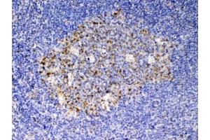IHC testing of FFPE human tonsil tissue with SCF antibody at 1ug/ml.