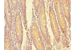 Immunohistochemistry of paraffin-embedded human small intestine tissue using ABIN7169145 at dilution of 1:100