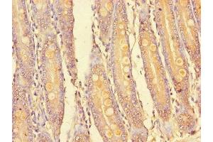 Immunohistochemistry of paraffin-embedded human small intestine tissue using ABIN7169145 at dilution of 1:100 (PIM2 anticorps  (AA 1-210))