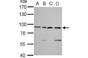 WB Image Ku80 antibody [N3C2], Internal detects XRCC5 protein by Western blot analysis. (X-Ray Repair Cross Complementing 5 anticorps)