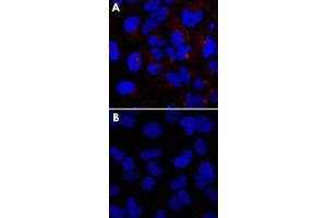HeLa cells stained with IFITM3 polyclonal antibody , without (A) or with (B) blocking peptide (P0250). (IFITM3 anticorps  (N-Term))