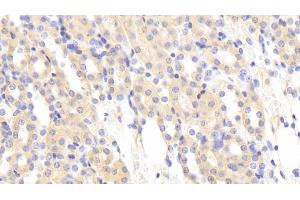 Detection of MASP1 in Mouse Kidney Tissue using Polyclonal Antibody to Mannose Associated Serine Protease 1 (MASP1) (MASP1 anticorps  (AA 25-453))