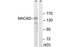 Western blot analysis of extracts from Jurkat cells, using NACAD Antibody. (NACAD anticorps  (AA 376-425))