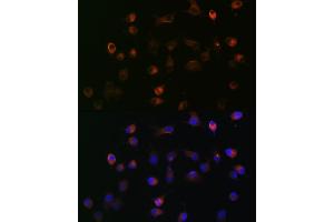 Immunofluorescence analysis of HeLa cells using γ-Catenin Rabbit mAb (ABIN1683043, ABIN3018625, ABIN3018626 and ABIN7101634) at dilution of 1:100 (40x lens).