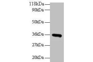 Western blot All lanes: CYC1 antibody at 2 μg/mL + EC109 whole cell lysate Secondary Goat polyclonal to rabbit IgG at 1/15000 dilution Predicted band size: 36 kDa Observed band size: 36 kDa (Cytochrome C1 anticorps  (AA 85-325))
