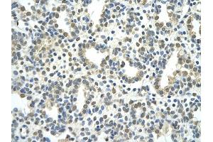 Rabbit Anti-NR2F2 antibody         Paraffin Embedded Tissue:  Human Lung    cell Cellular Data:  alveolar cell    Antibody Concentration:  4.