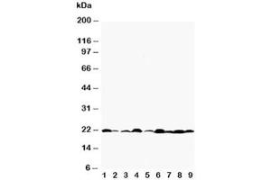 Western blot testing of Bax antibody and Lane 1:  rat testis