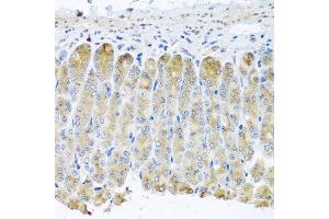 Immunohistochemistry of paraffin-embedded mouse stomach using TAMM41 antibody at dilution of 1:100 (x40 lens). (TAM41 anticorps)