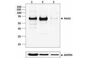 Western Blotting (WB) image for anti-Recombination Activating Gene 2 (RAG2) antibody (ABIN2666293) (RAG2 anticorps)