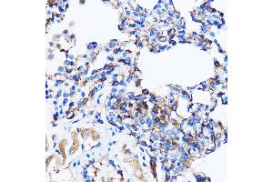 Immunohistochemistry of paraffin-embedded Rat lung using p38 MAPK Rabbit pAb (ABIN7268615) at dilution of 1:100 (40x lens). (MAPK14 anticorps  (AA 1-360))