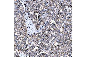 IHC analysis of SEMA4F using anti-SEMA4F antibody (ABIN7601432).
