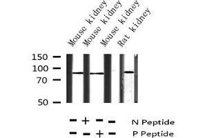 Western blot analysis of Phospho-Tau (Ser404) expression in various lysates (MAPT anticorps  (pSer404))