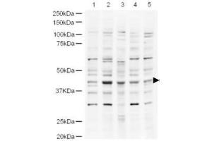 Image no. 1 for anti-Ubiquitin Specific Peptidase 18 (USP18) (AA 40-49) antibody (ABIN401252) (USP18 anticorps  (AA 40-49))